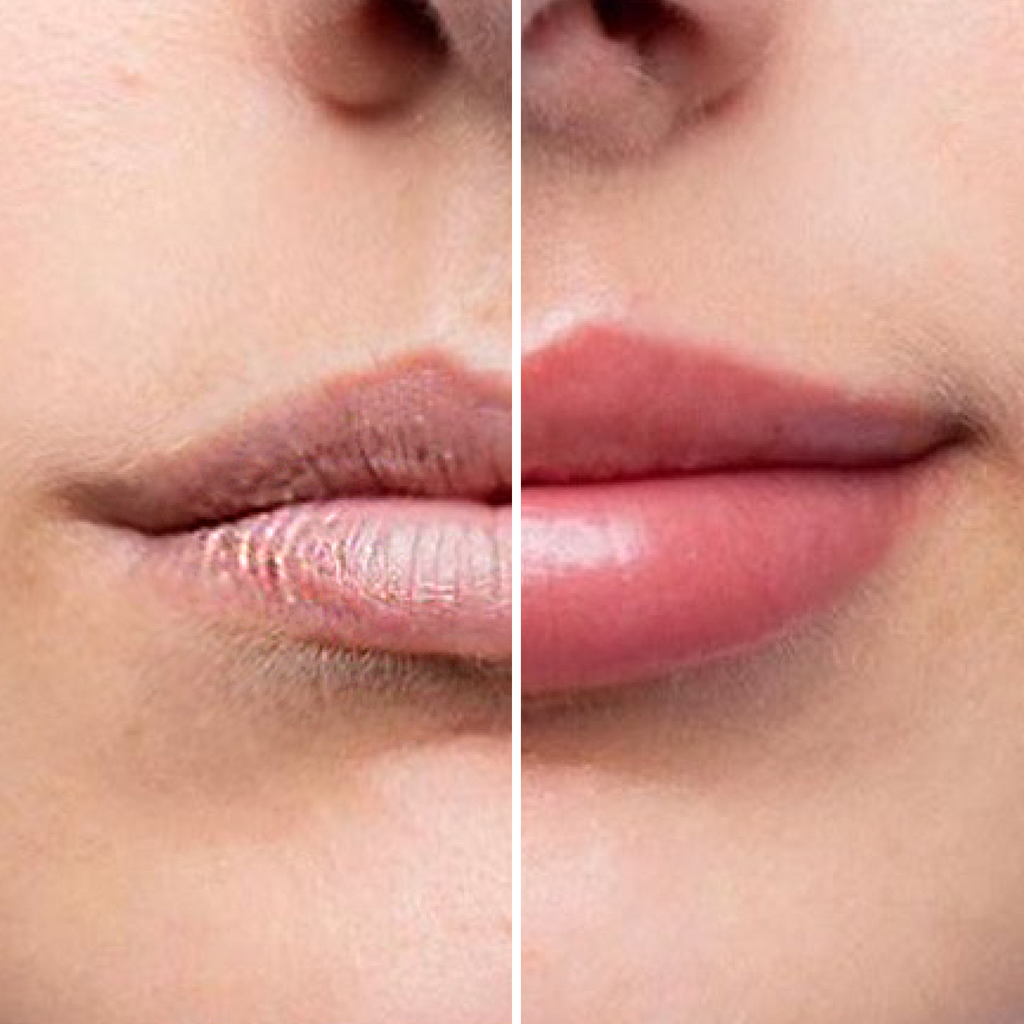 Ser Pentru Marirea Buzelor - Magic Lips